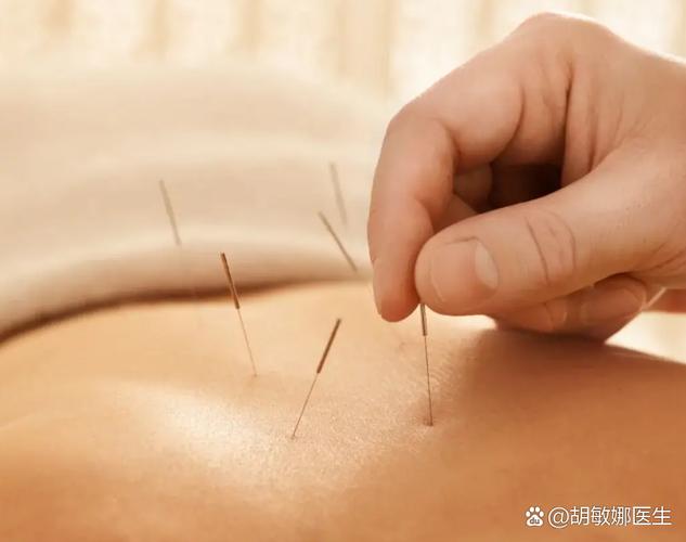 针灸减肥当天同房了