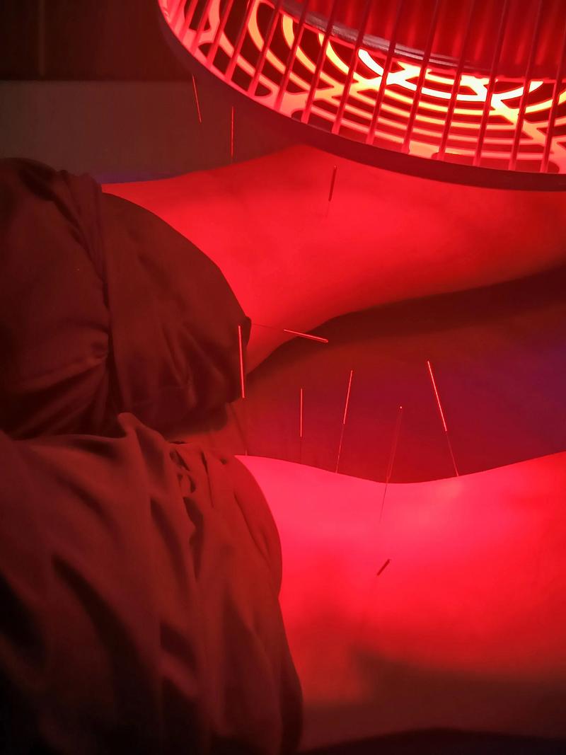 汪司右 针灸 效果