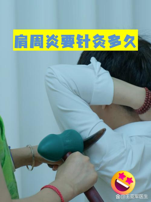 肩周炎针灸几天能好