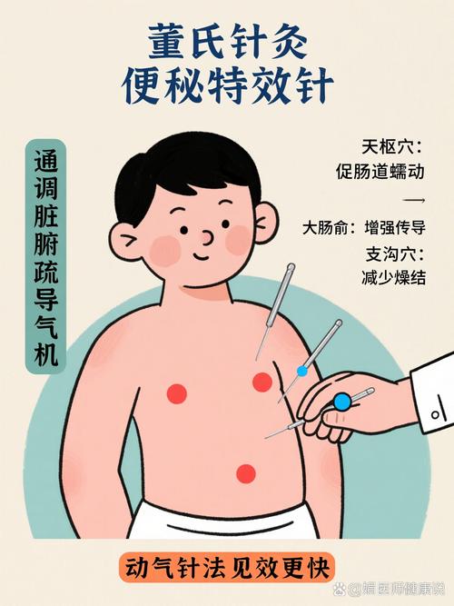 便秘针灸多久有效果