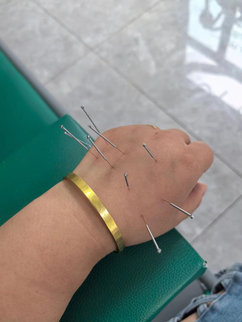 大连哪个医院针灸好