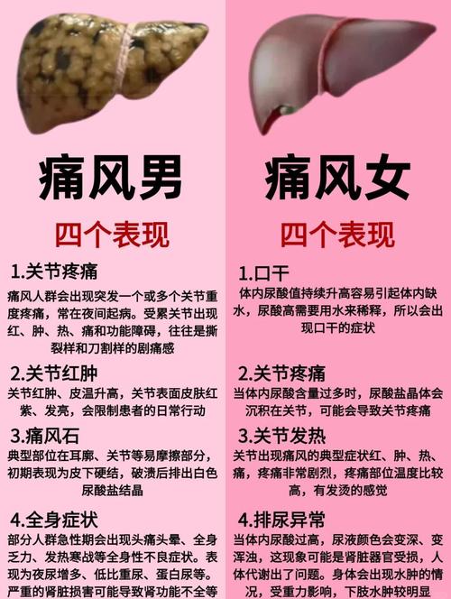 女性为什么会得痛风