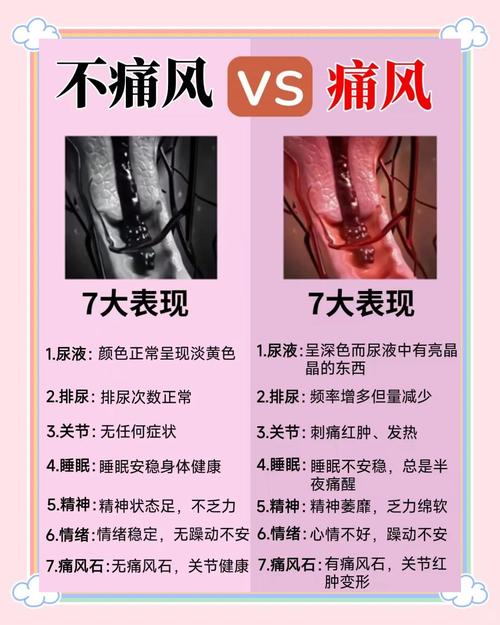 女性为什么会得痛风