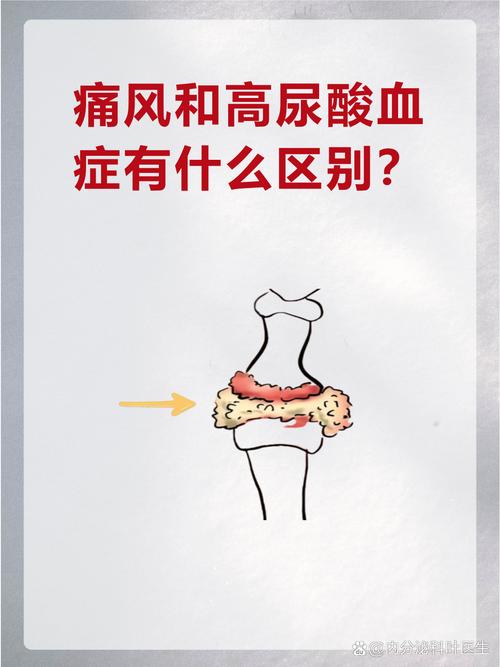 尿酸正常会不会痛风