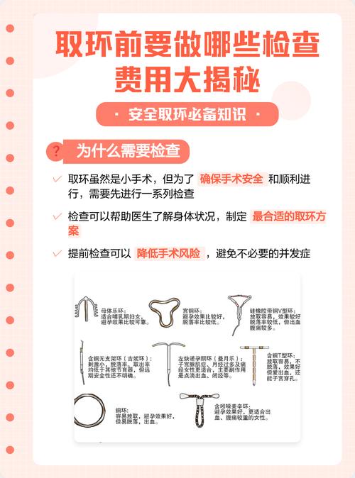 哪种环最安全副作用小