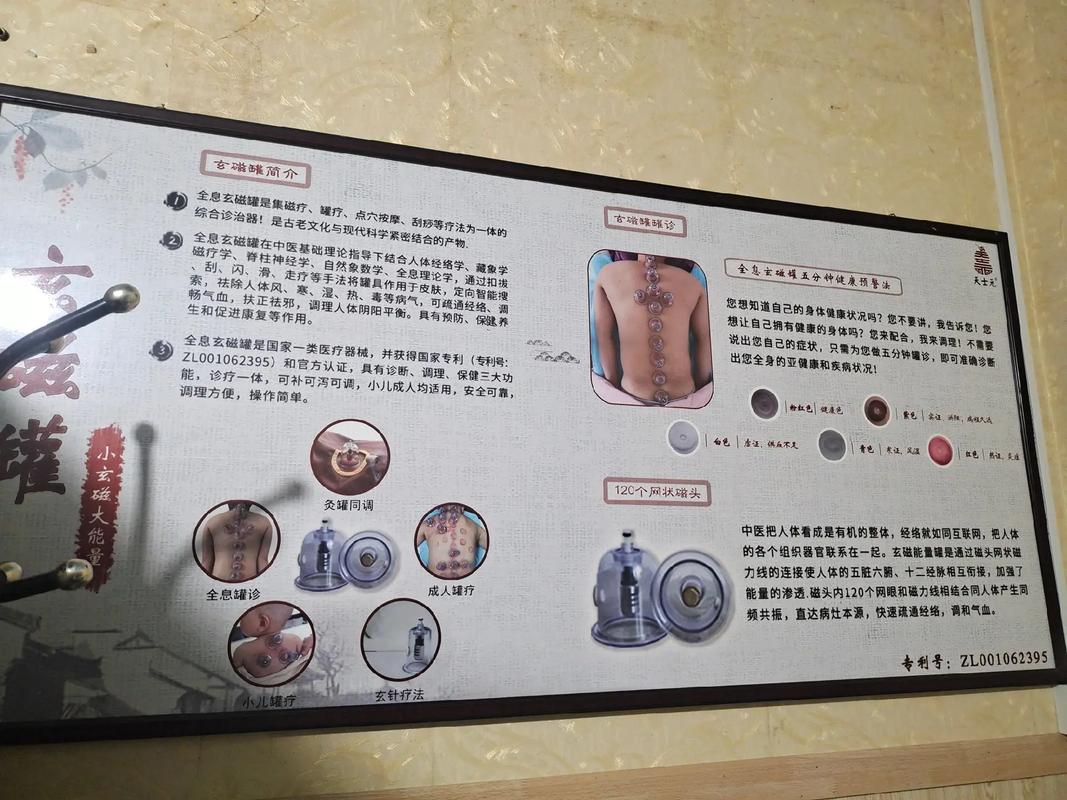 磁疗针灸器罐子价格