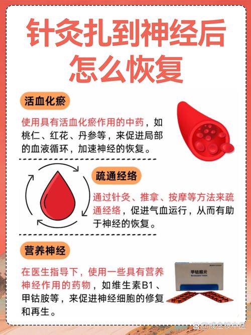 面瘫几天可以扎针灸