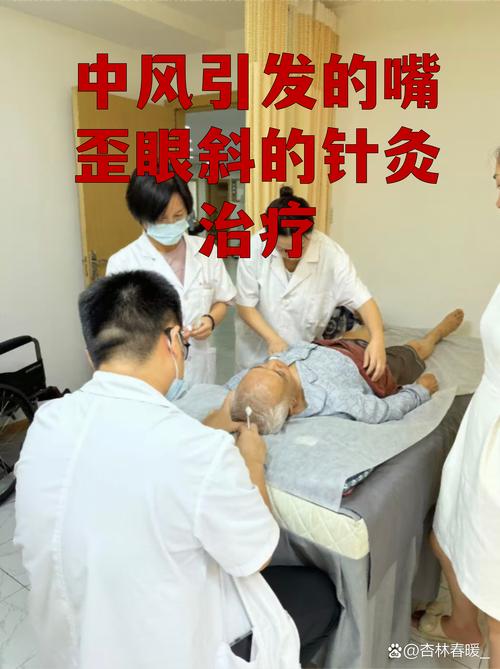 眼睛重影针灸眼神经