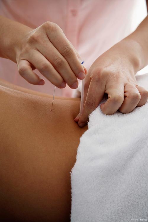 常州哪里有针灸减肥
