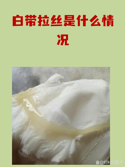 安全期同房后白带拉丝