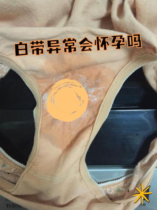 安全期同房后白带拉丝