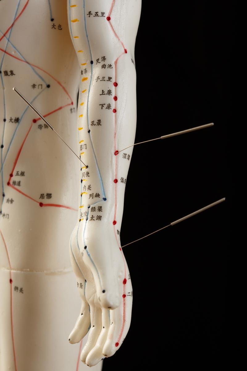 武汉针灸推拿哪里好