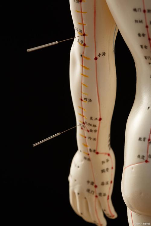 武汉针灸推拿哪里好