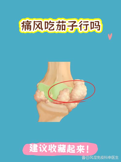 痛风病人可以吃肉吗