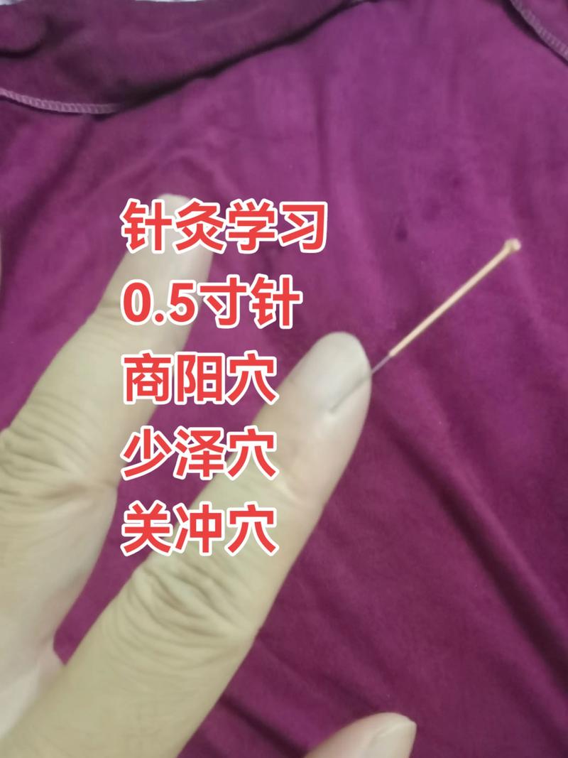 南京哪里可以学针灸