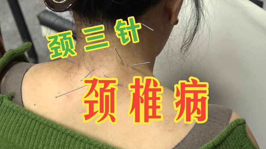 南京哪里可以学针灸