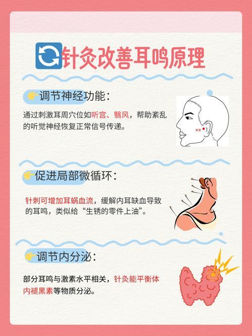 针灸对耳鸣是否有效