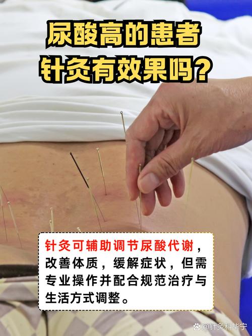 针灸可以治疗湿寒吗