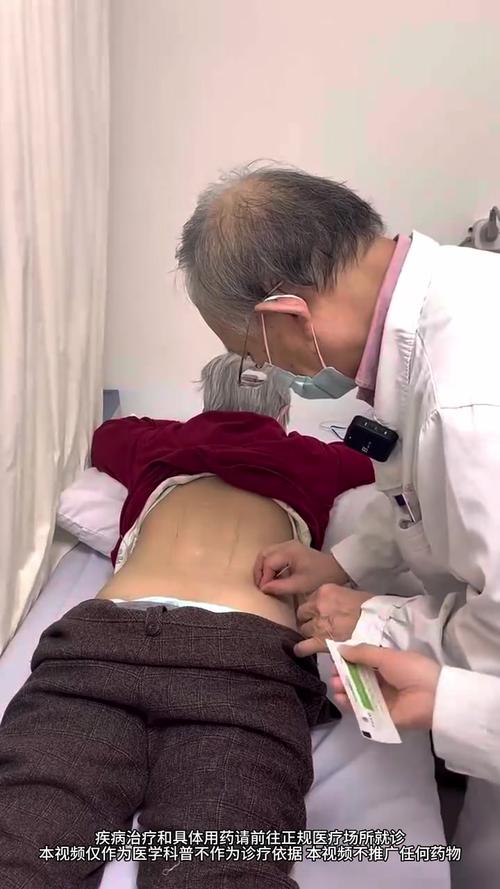 董氏针灸治疗腰腿痛