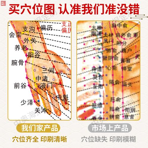 针灸穴位挂图超清版
