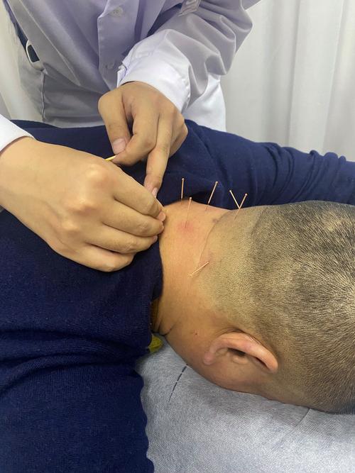 中医养生馆针灸推拿