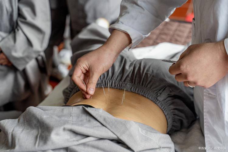 北京哪里可以学针灸