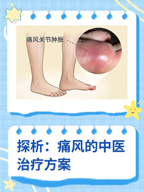 青少年痛风如何治疗