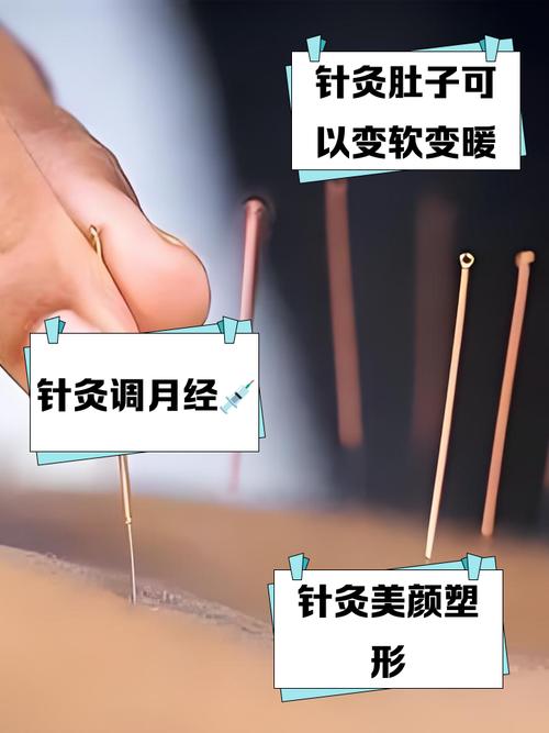 痛经的针灸治疗方法