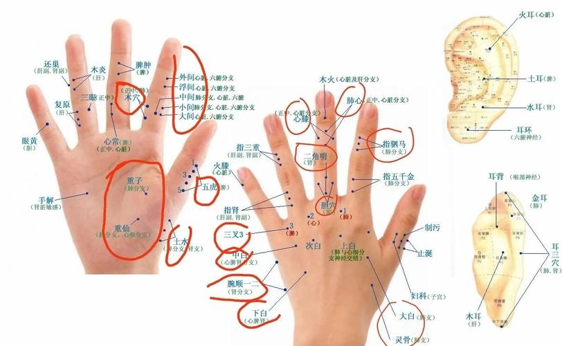 针灸穴位可以治痛风