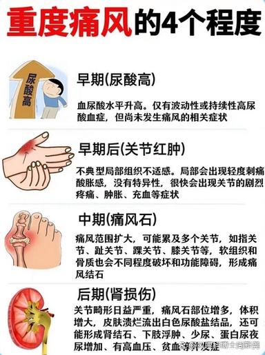 痛风时间长了会怎样