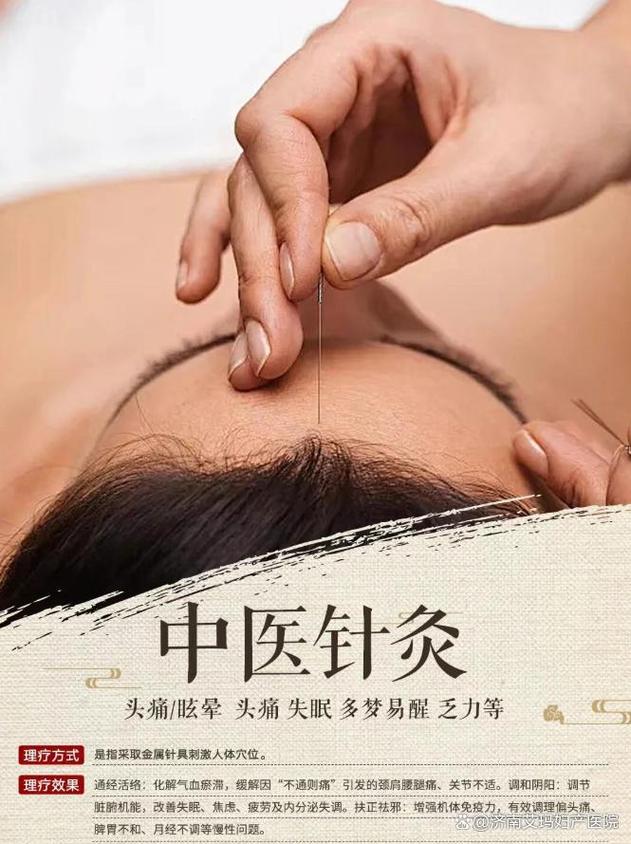 针灸治疗失眠要多久