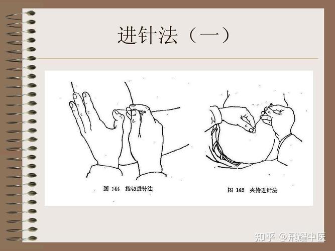 针灸无痛进针法视频