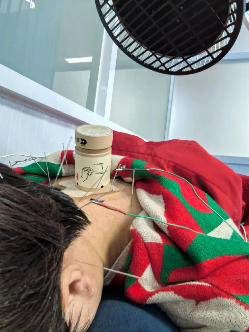 沈阳哪个医院针灸好
