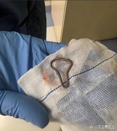 目前哪种环最好最安全