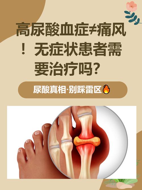 痛风是因为尿酸高吗