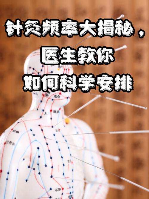 每天针灸对身体好吗