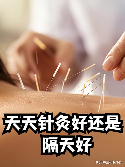 针灸可以治疗崩漏吗