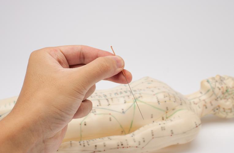 针灸真能帮助怀孕吗