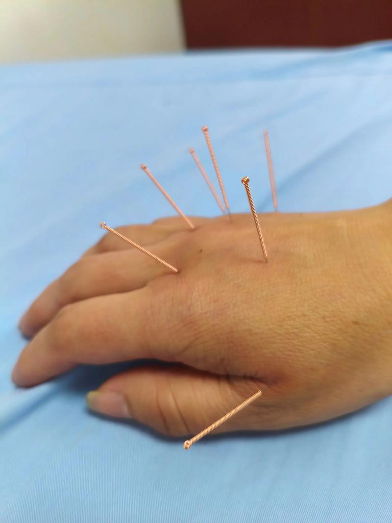 声音嘶哑怎样打针灸