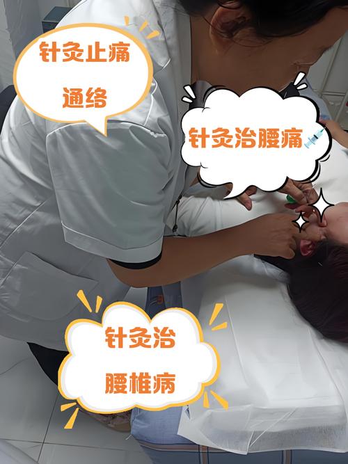 针灸治疗腰腿痛视频
