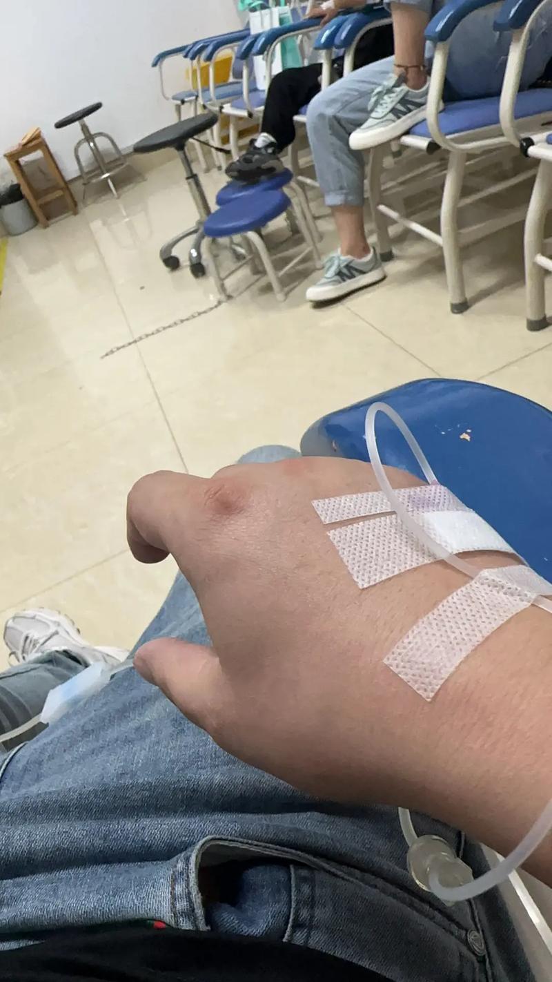 痛风挂水后几天可好