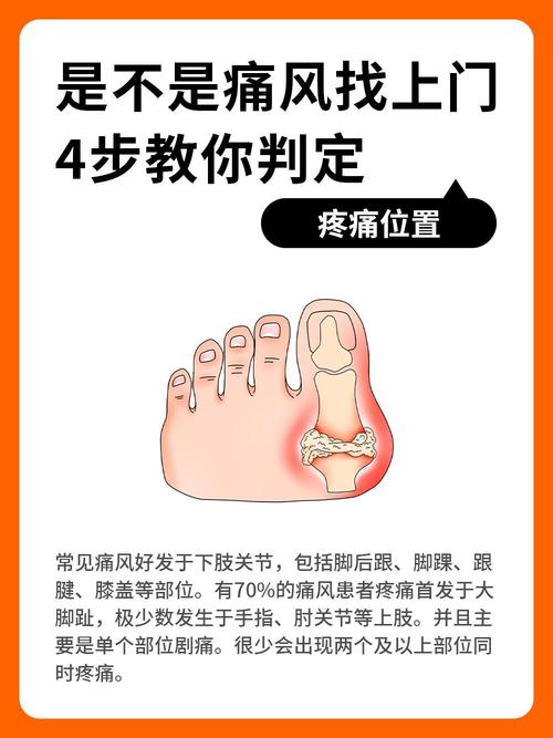 大脚趾麻木是痛风吗