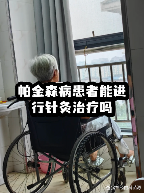 中医针灸治疗帕金森