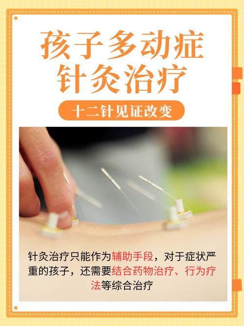 针灸治疗小儿多动症