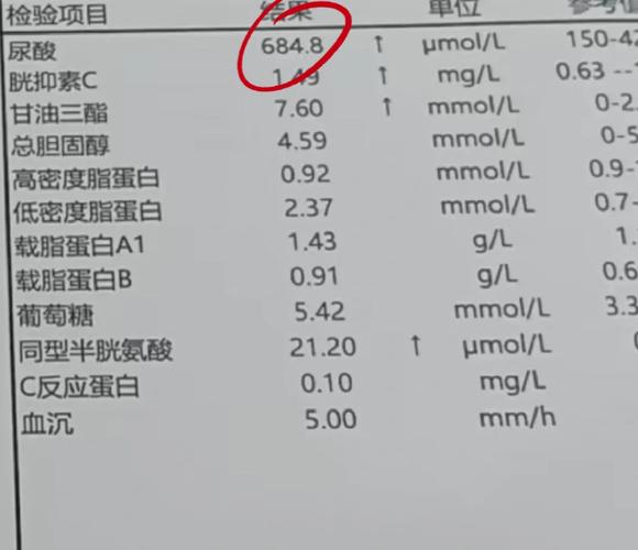 验血查痛风挂什么科