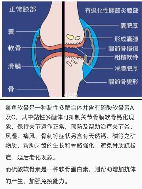 痛风能吃鲨鱼软骨吗