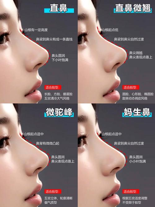 现在做鼻子哪种最安全