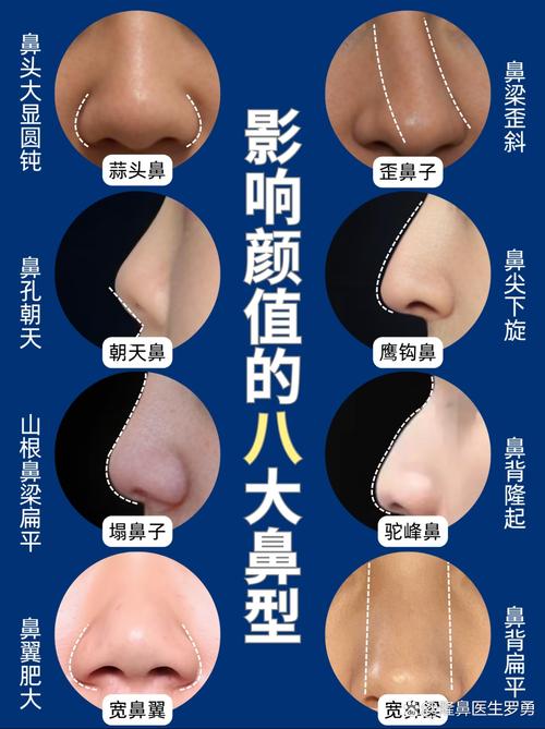 现在做鼻子哪种最安全