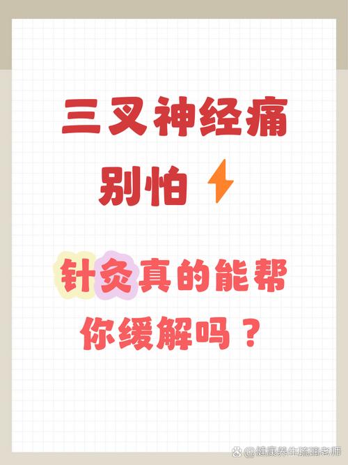 三叉神经痛针灸行吗