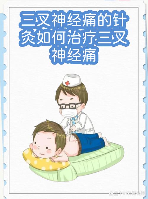 三叉神经痛针灸行吗